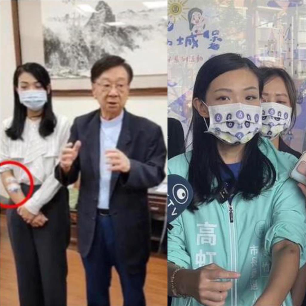 演很大?高虹安右手打點滴秀「左手淤青」 苦苓:又創造一個奇蹟