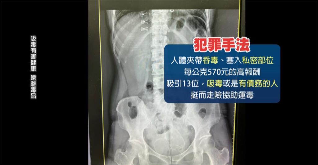 塞私處、吞毒闖關不要命　前國手「臥病在床」靠手機操盤