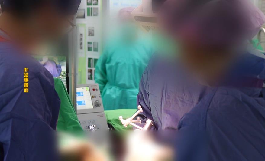 新影片曝光！　醫材業者對女病患開刀　主刀醫師未穿手術衣一旁「抱胸監督看」