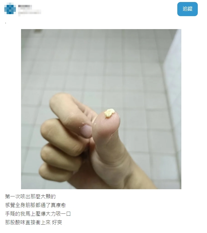 男大生咳出「超臭白色珍珠」喊超過癮!過來人一看:專屬你的龍延香