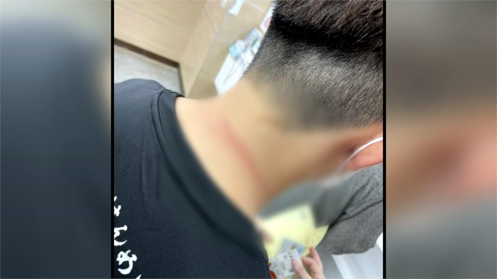 打火英雄慘淪沙包! 警消協助送醫竟被病患打