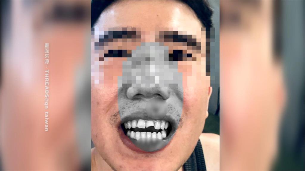 桃園男走人行道遭電線絆倒「門牙裂、腦震盪」 議員怒:人本交通呢?