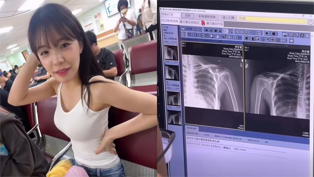 李多慧身體出事!膀韌帶發炎「痛到尖叫」醫示警:不做1事「恐無法跳舞」