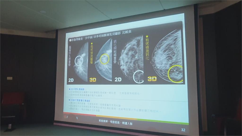 疫情影響乳癌篩檢人數銳減　宜蘭羅東博愛醫院推乳房3D攝影快速通道