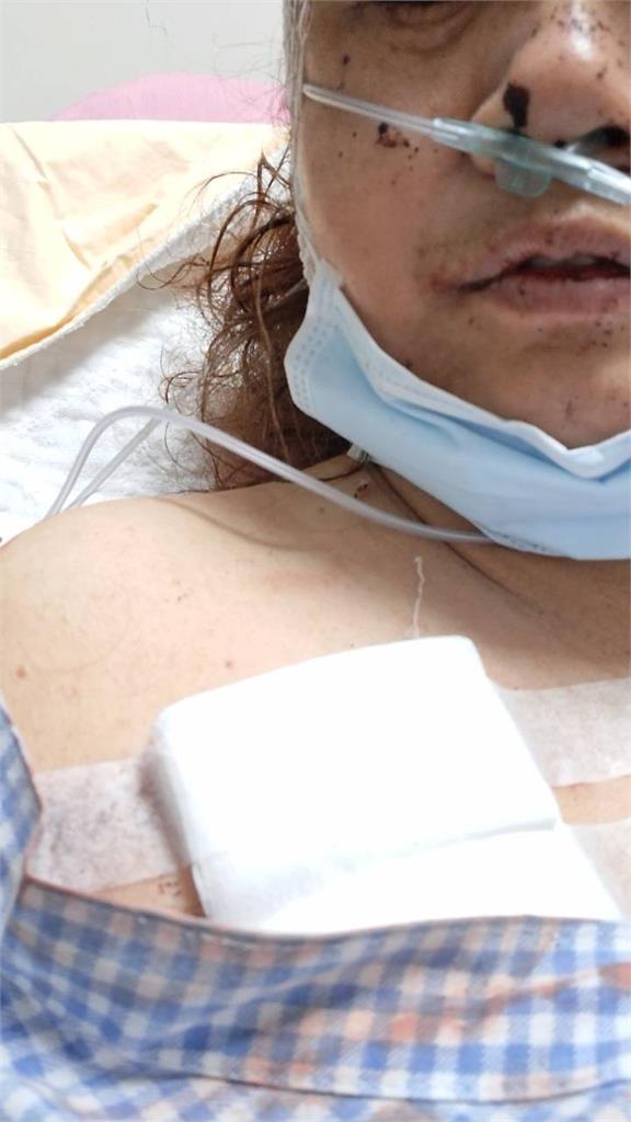 快新聞／高雄科技大廠女保全突遭男友砍！恐怖情人還放話「殺你媽媽」