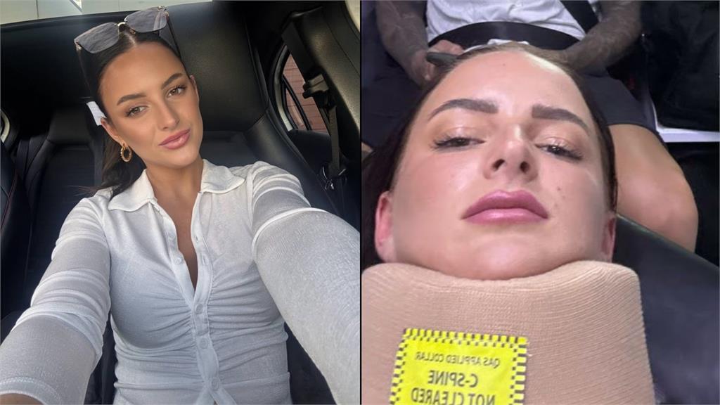 22歲正妹遭追撞「鯊魚夾」瞬間破碎！醫師曝：金屬材質更致命