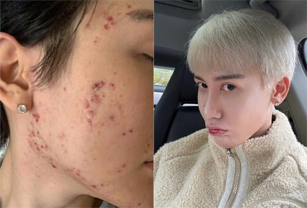 還記得蛇精男?超樸素「0修圖」近照曝光 網震驚:現在帥好多