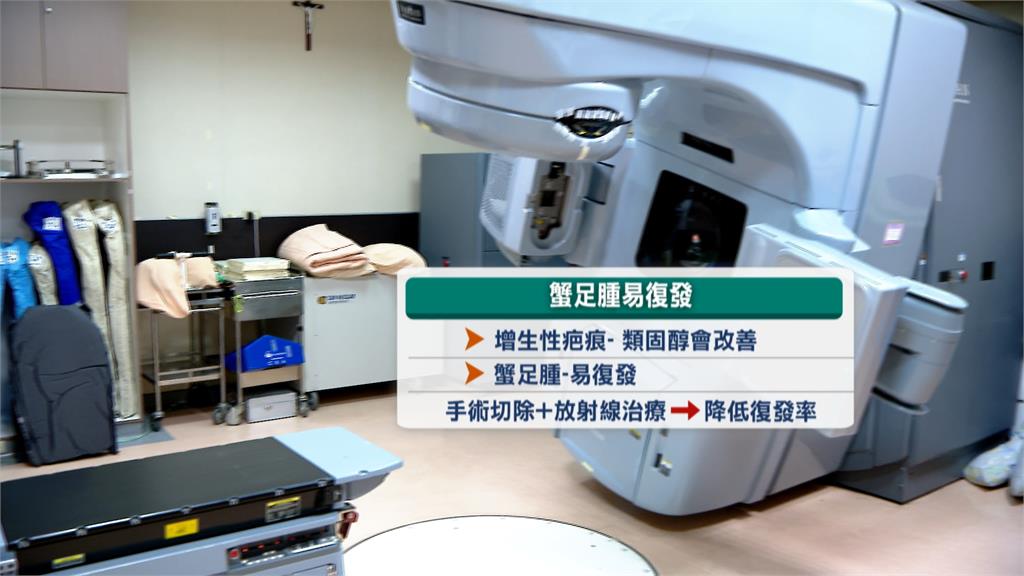 疤痕消不掉、凸起發癢 傷口未正常癒合恐是「蟹足腫」