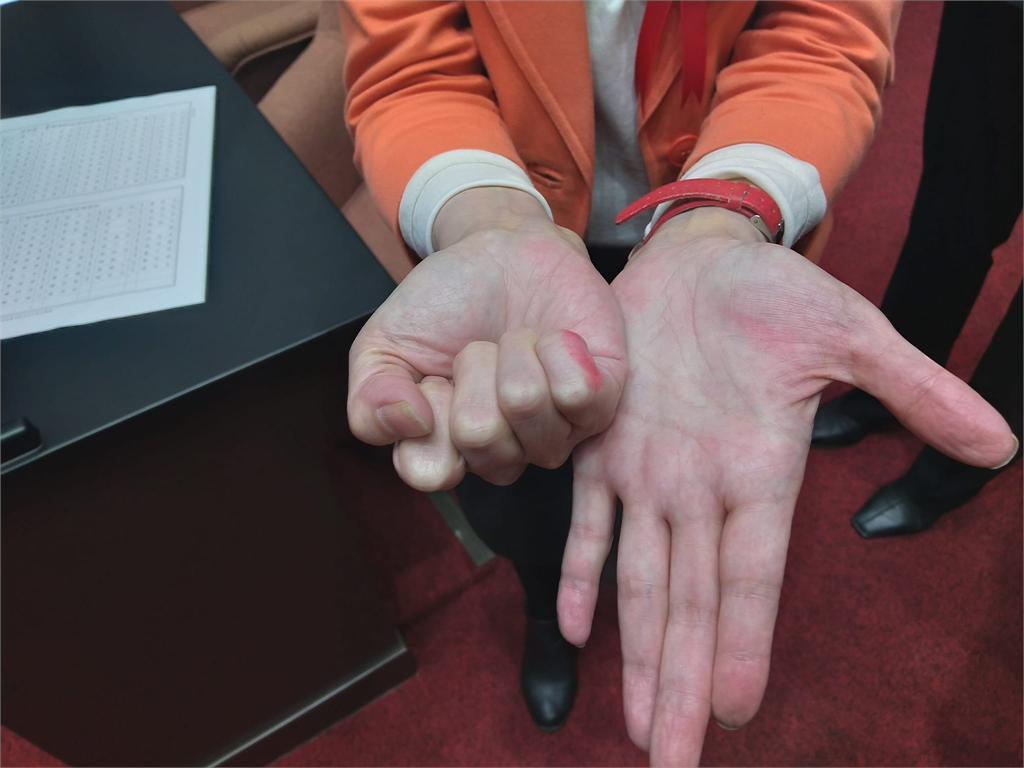 立法院長選舉／「選票爭議」 民眾黨陳昭姿認了致歉：手指轉印沾到選票