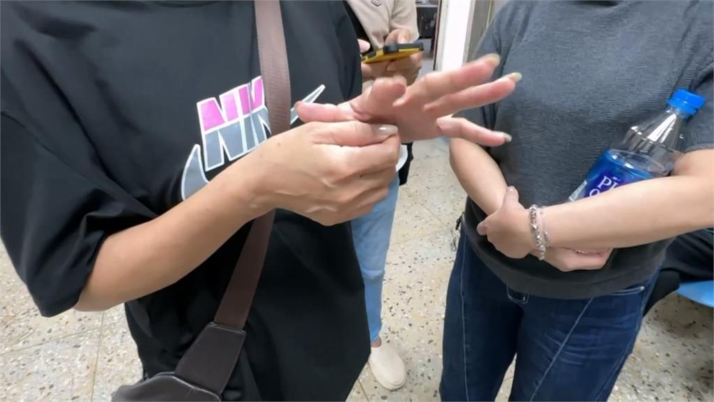 割眼袋喪命！45歲女麻醉後昏迷　送醫驚見胃穿孔急救11天亡