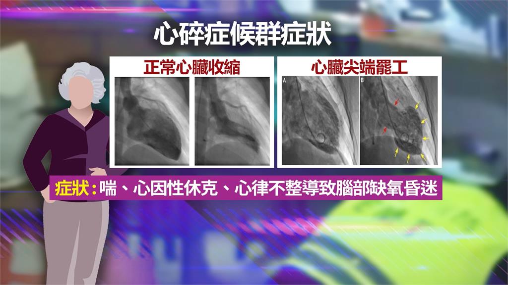 打麻將昏倒一度無呼吸心跳 太興奮?婦人患「心碎症後群」