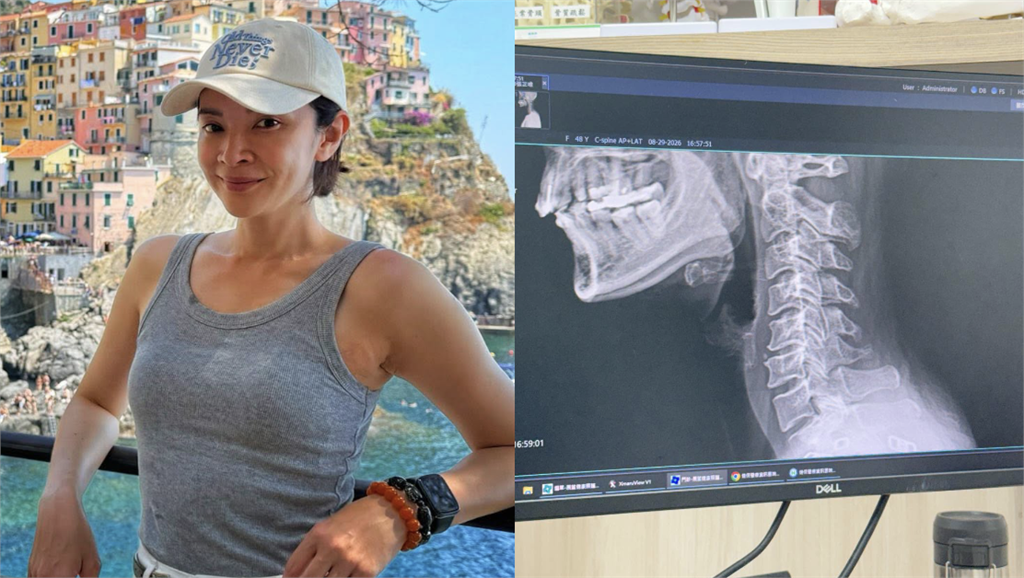 連筷子都拿不穩！48歲女星驚爆「中風前兆」急奔醫院　真實病況曝光