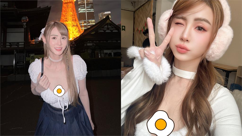 短今突PO「門牙缺一角」近距離照！竟是「吃飯吃進肚」…她崩潰喊：要瘋了