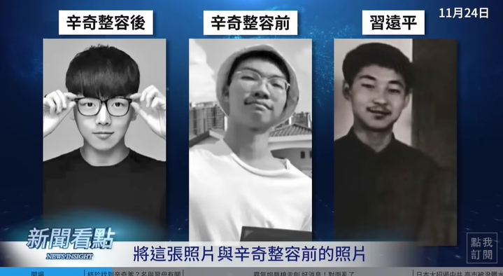 于朦朧遭爆「戴矽膠假耳」畫面曝！他曬右臉「辛」字烙印照：盼于粉出面