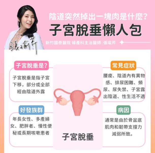 婦人如廁發現「陰道突出一塊肉」！醫：子宮脫垂竟拖到第四度才就診