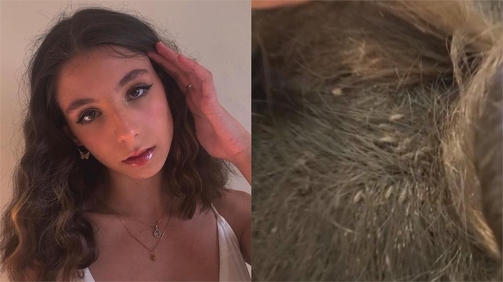 美女治療師翻開13歲妙齡女長髮　驚呆網友：洗頭很困難嗎