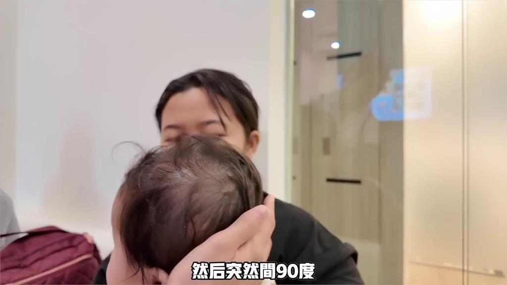 天生頭型不好看！7個月大兒患扁頭症　「需戴頭盔矯正」媽心疼：對不起