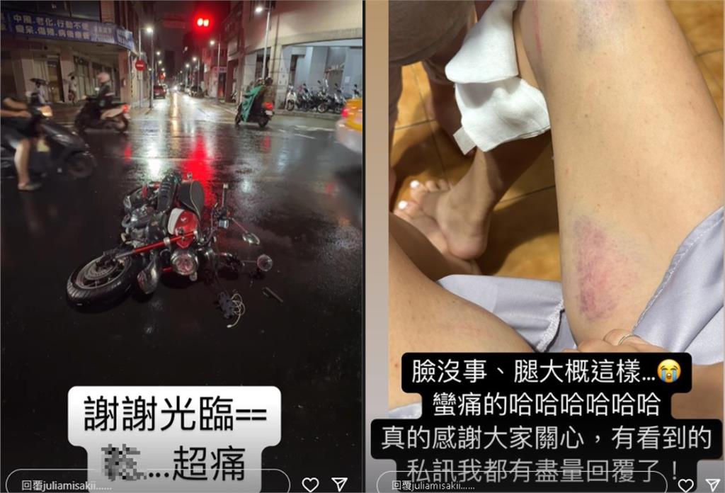 台中高鐵「長髮嫩妹」是重機女神!車禍後1個月近況震撼網:是不是有點…