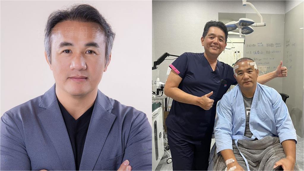 中職/不只曾豪駒!資深球星「髮」術太神了 昔日職棒男神「回春秘密」全挖出