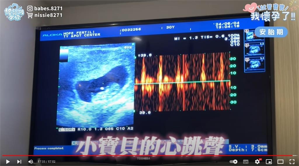 陳妮絲閃嫁2個月甜曬寫真 曝「婚後真實身材」原因網驚:居然都沒發現!