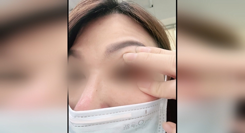 吃腸粉雙眼紅腫？　民眾疑食材不新鮮　業者澄清