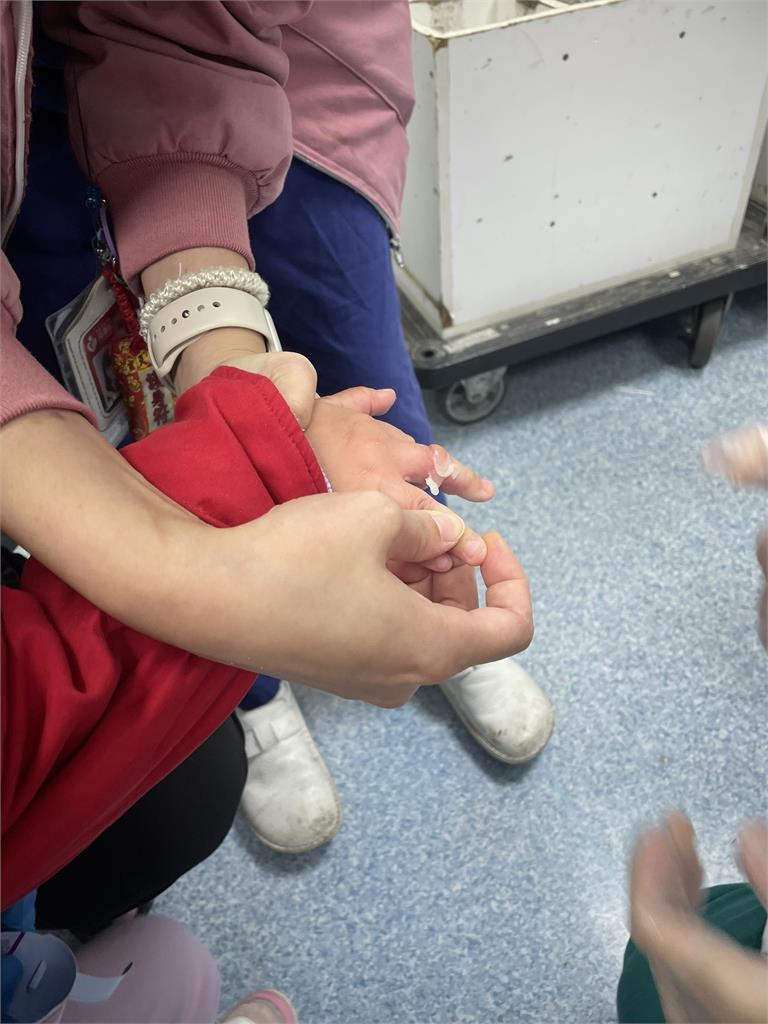 女童中指卡塑膠椅洞　嚎啕大哭　消防「連人帶椅」送醫拆剪