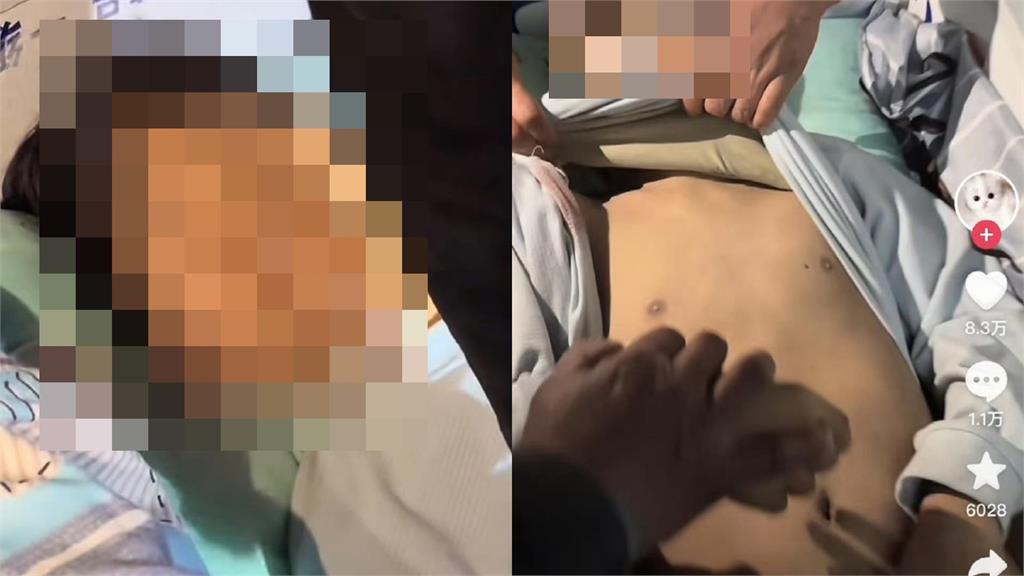 中國高中生「宿舍慘死」遭醫院偷運走、家屬崩潰攔車！遺體「胸口有大洞」死狀驚悚