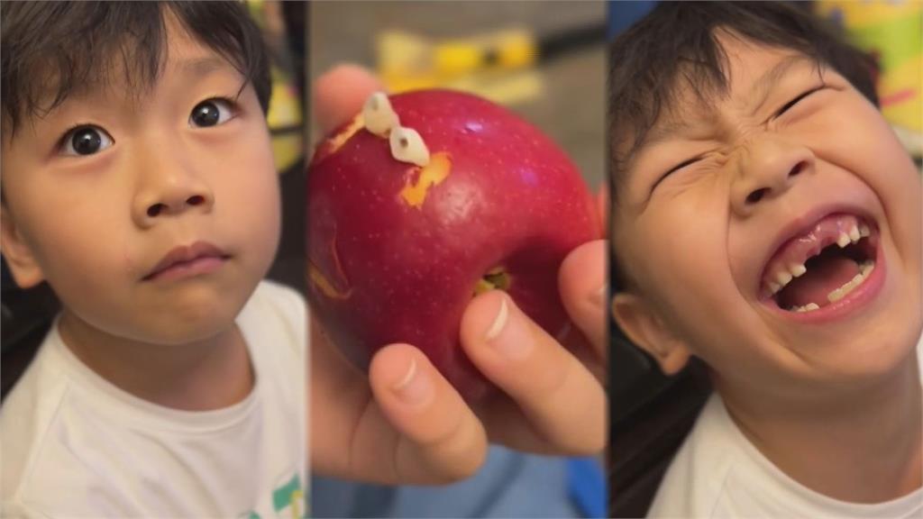 啃蘋果掉下「2顆牙齒」？6歲男童沒門牙燦笑影片曝光　網揭2點轟擺拍