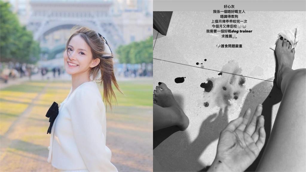 甜美女星遭狗咬「滿地都是血」驚悚畫面曝光…她因「這理由」超自責：很灰心