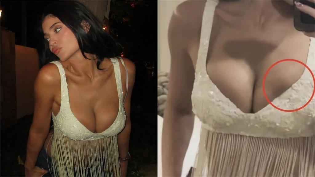 甜茶名媛女友上身驚現「神秘低窪」！網瘋傳「假體破裂？」本人竟是這反應