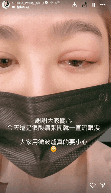 8點檔林志玲「微波爐煮雞蛋」爆炸!眼角膜破洞、皮膚燙傷「送醫慘況曝」