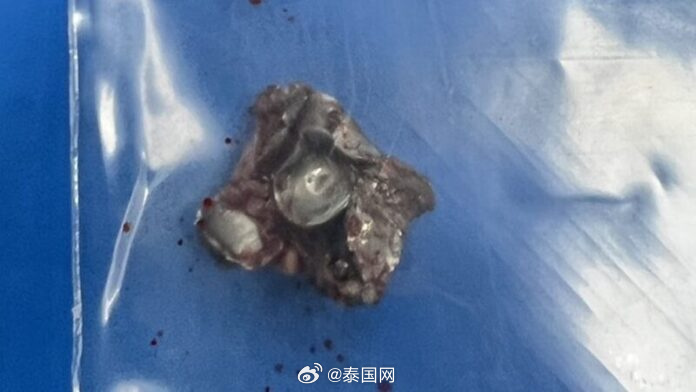 射擊場爆流彈意外!中國女遊客遭擊中臉部「子彈穿臉留黑洞」驚悚照片曝光