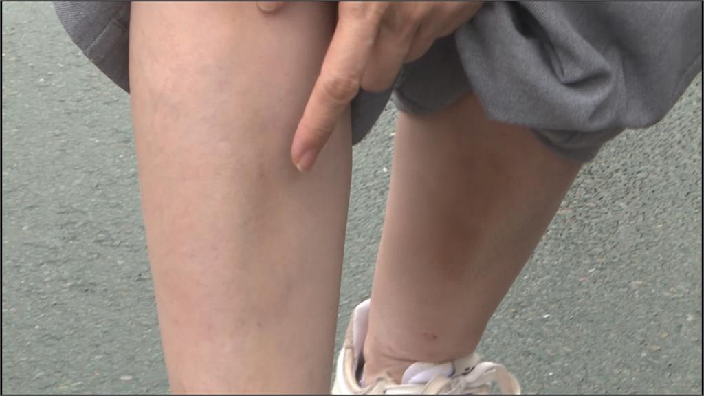 立院全武行! 陳培瑜「輕微腦震盪」 控遭陳玉珍狂踹喊告