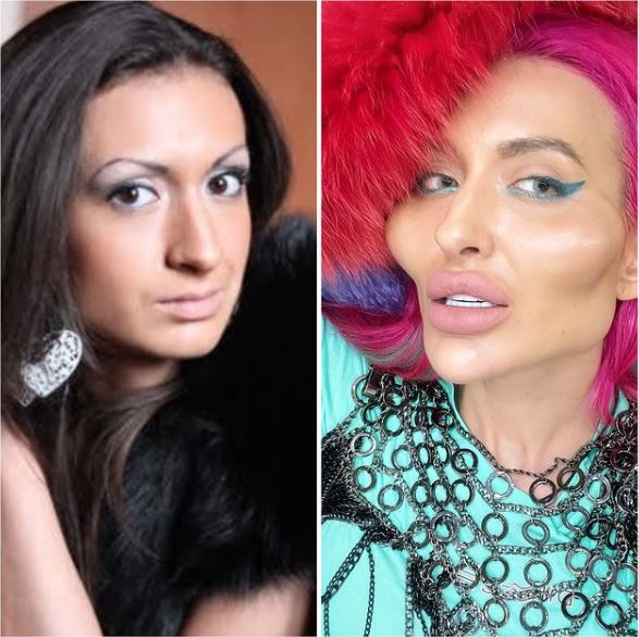 烏克蘭模特兒21歲天然照曝光　就愛「世界最大臉頰」堅持整型