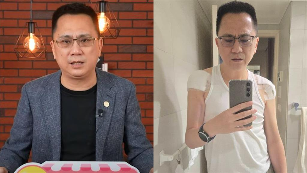 56歲486先生開刀激瘦!一早無預警「衝醫院報到」病況引網憂心:保重
