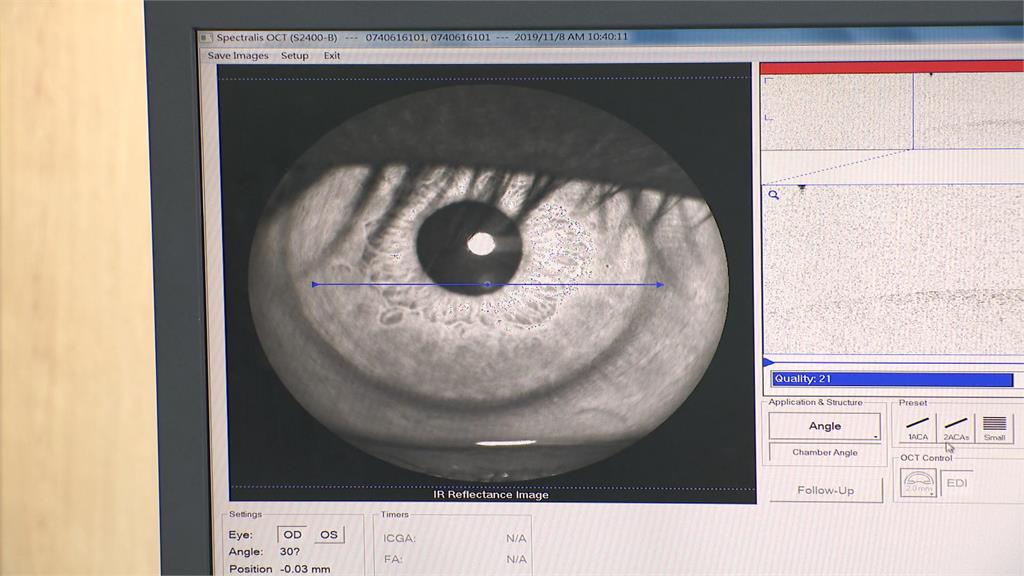 偏郷眼科醫療資源不足! 彰化當地醫院啟動"點睛計劃"