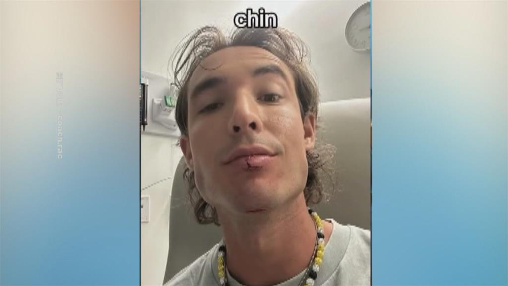 美棒球員克魯茲CNN演後空翻　臉部朝下重摔出糗演出