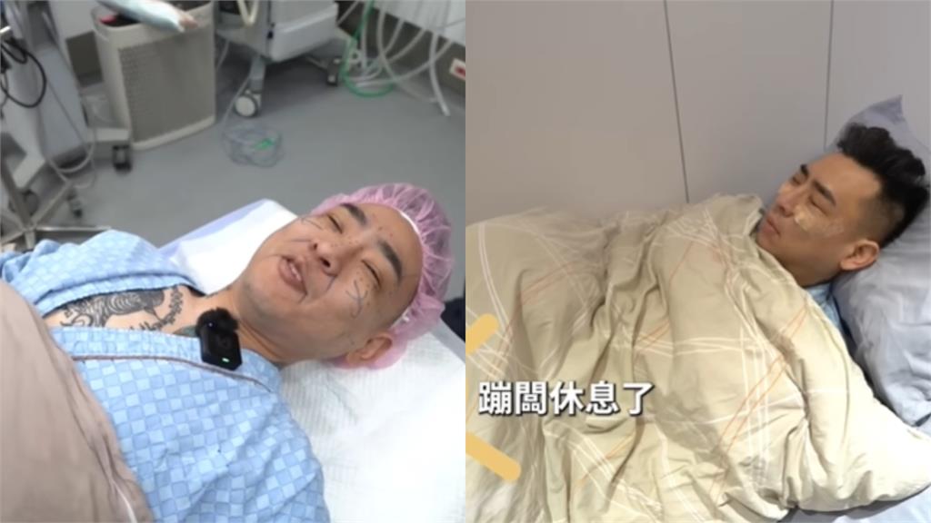 37歲蹦闆再進化！暴瘦狂甩45公斤「無預警突開刀」狠燒50萬近況曝
