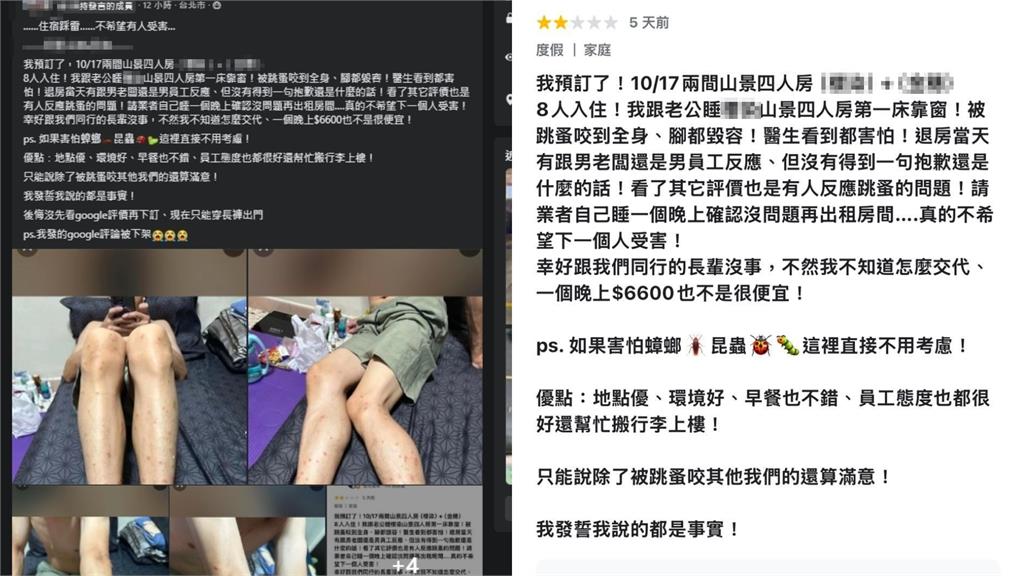 $6600民宿…跳蚤咬到「全身紅豆冰」超崩潰 網一片嚇傻:真的皮在養!