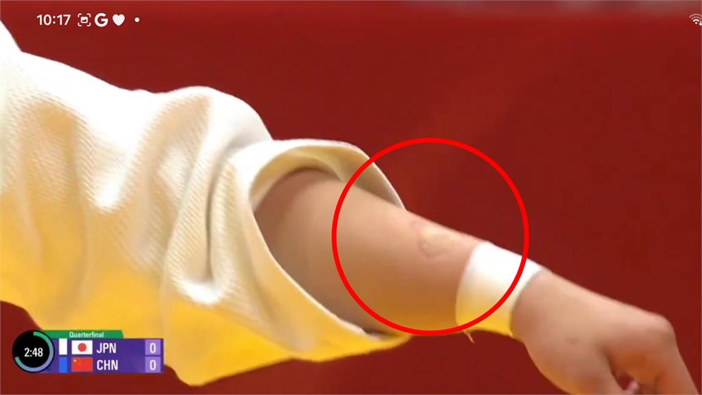 亞運柔道中國女將竟「死不鬆嘴」咬傷日選手！「心型齒痕」全被拍…超慘下場曝光