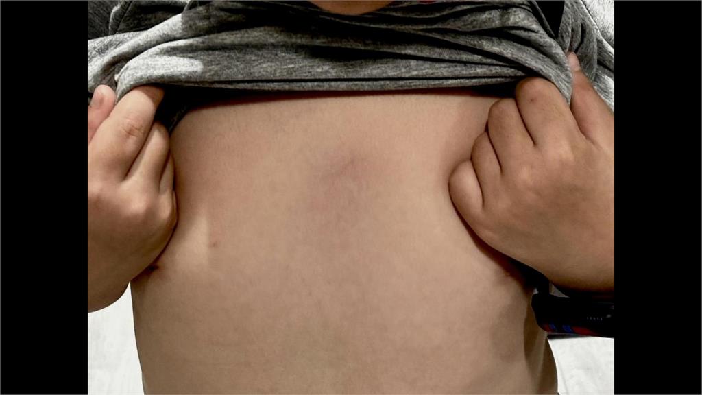 台南安親班傳不當管教　家長控孩子功課出錯遭老師肘擊