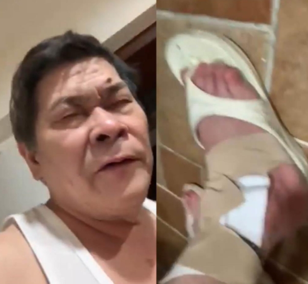頂嚴重腳傷上陣!澎恰恰憶「母親37年前教誨」硬撐:別讓人家看出來