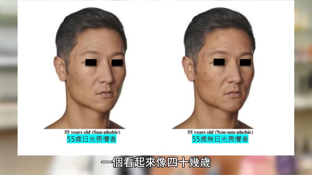 幾歲肌膚沒了彈性？醫喊把握11要點預防老化：避免重覆臉部表情