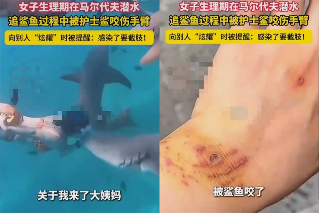 中國女飛馬爾地夫生理期下海遭「鯊魚狠咬手」！1態度挨轟：應該一口咬掉腦