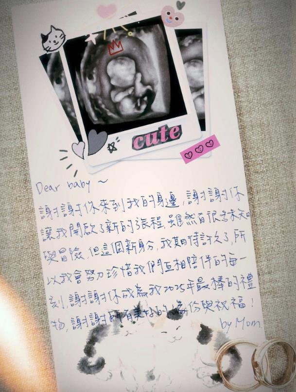 夏于喬「嫁大8歲導演尪6年」懷孕了！曬超音波照：2025年末最大獎