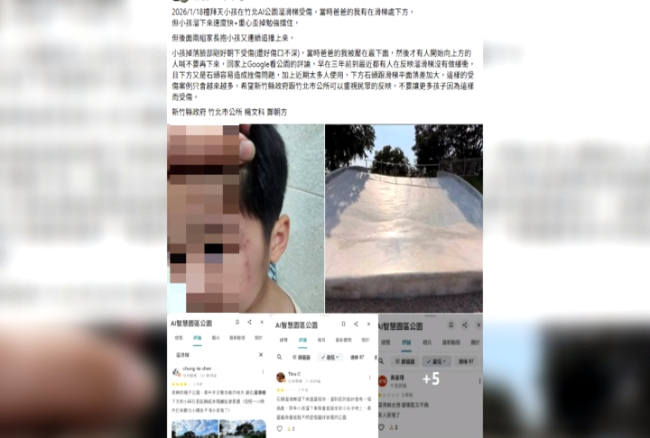 兒玩新竹「大碗公溜滑梯」額頭破洞　家長怒控：無保護機制