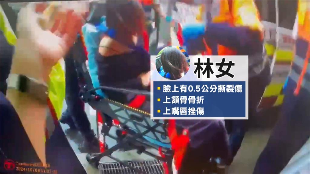 24歲正妹剛下公車竟被打暈口鼻流血　當事人：險失去意識　