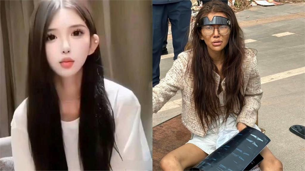 20歲「斷腿女網紅」流浪柬埔寨！回中國藥檢被驗「2毒陽性」家屬全說了