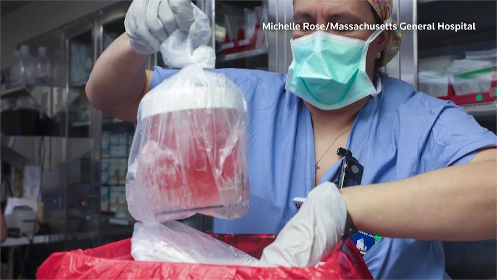 全球首例基改豬腎移植患者 術後近2個月身亡
