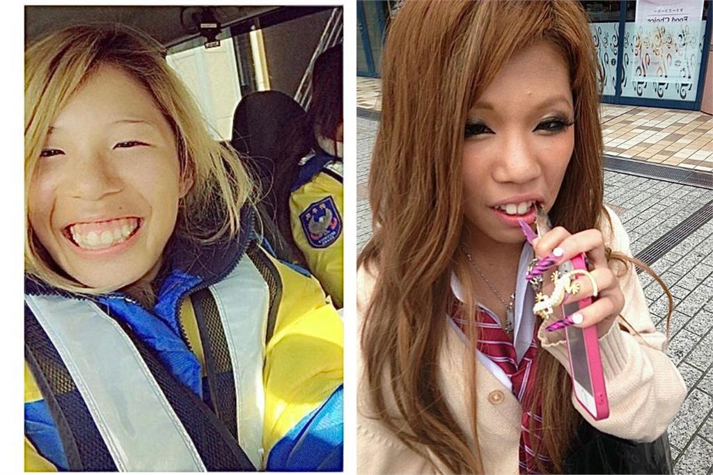 2600萬變臉超值!日本寫真女星公開整容細項 網讚對比照:真的非常努力